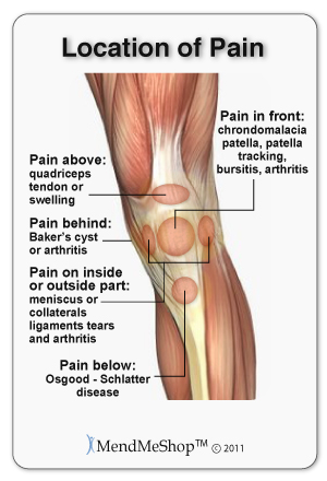 Knee Strain Vs Sprain